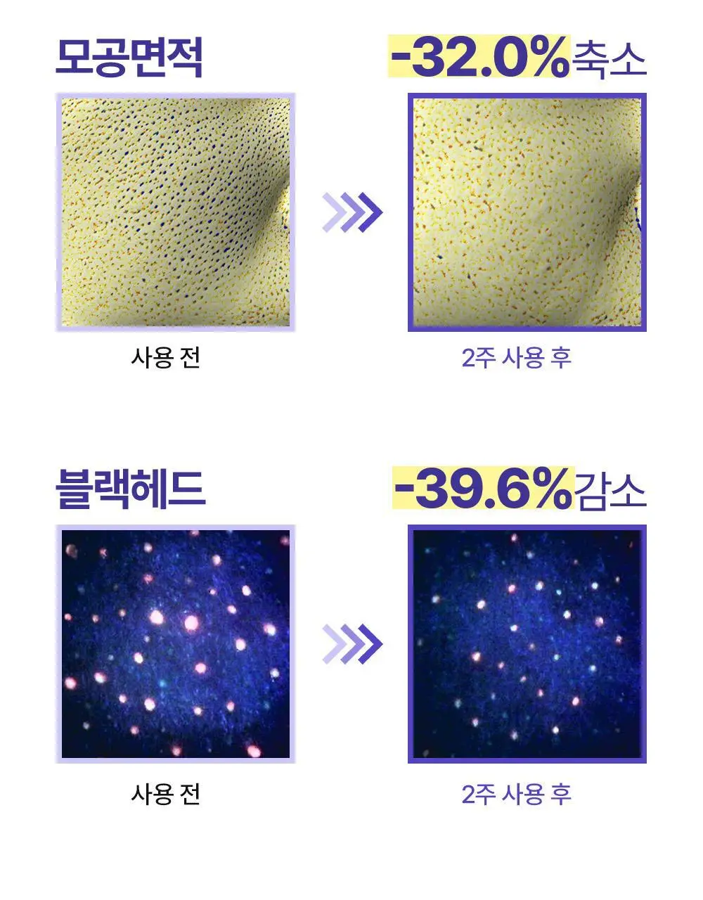 [모공케어] 무슈제이 레티놀로지 데일리 리페어 (로션/에센스) 택 1 상세페이지 25